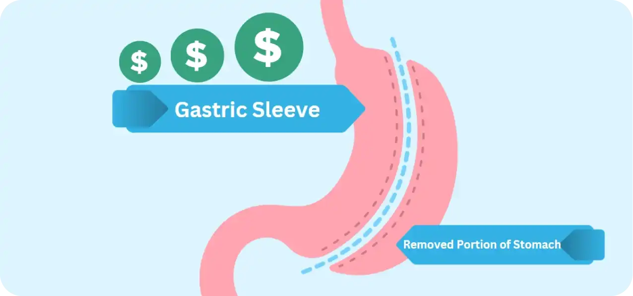 Gastric Sleeve Surgery Costs in Turkey 2026: What’s Really Included?