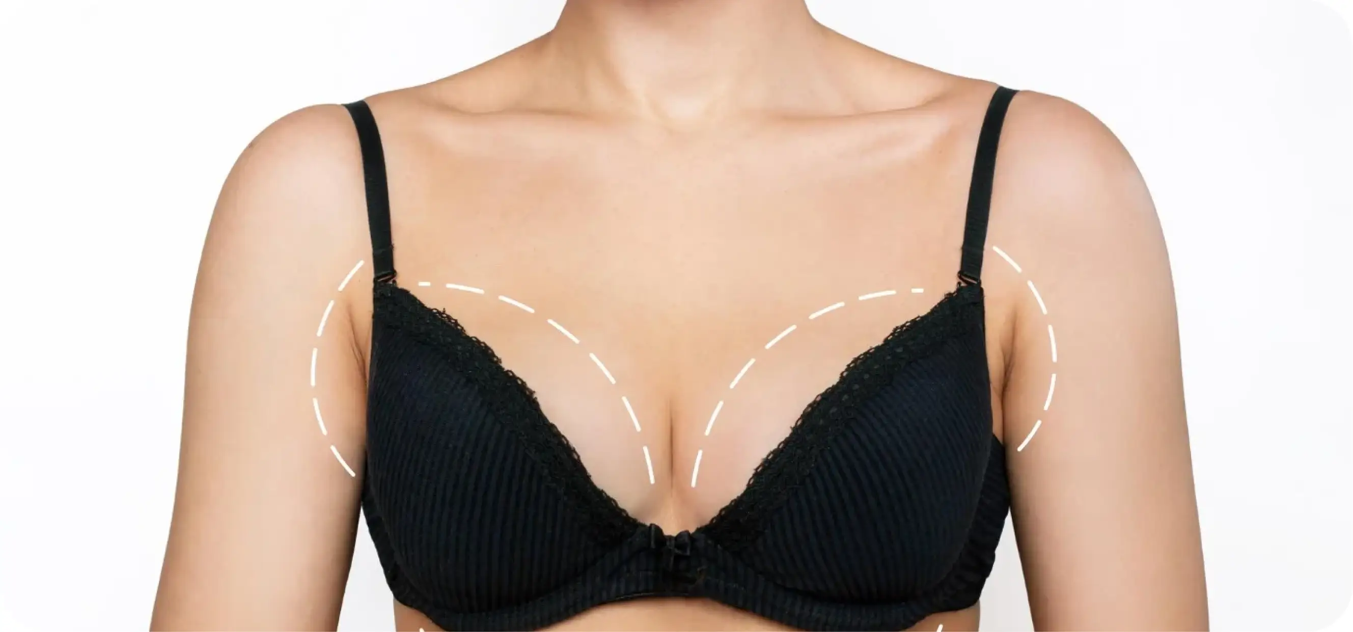 Breast Enhancement