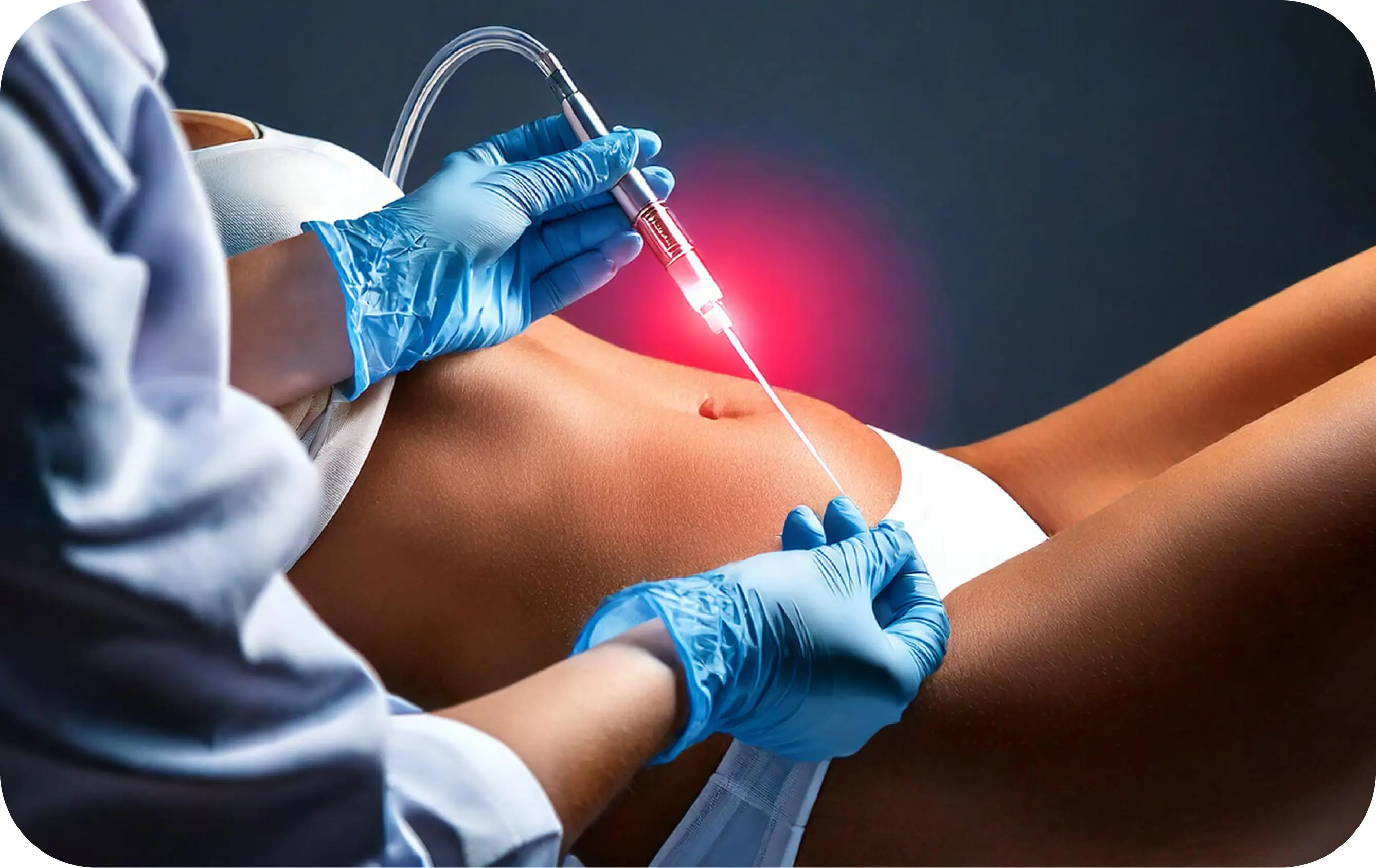 J-Plasma Surgery