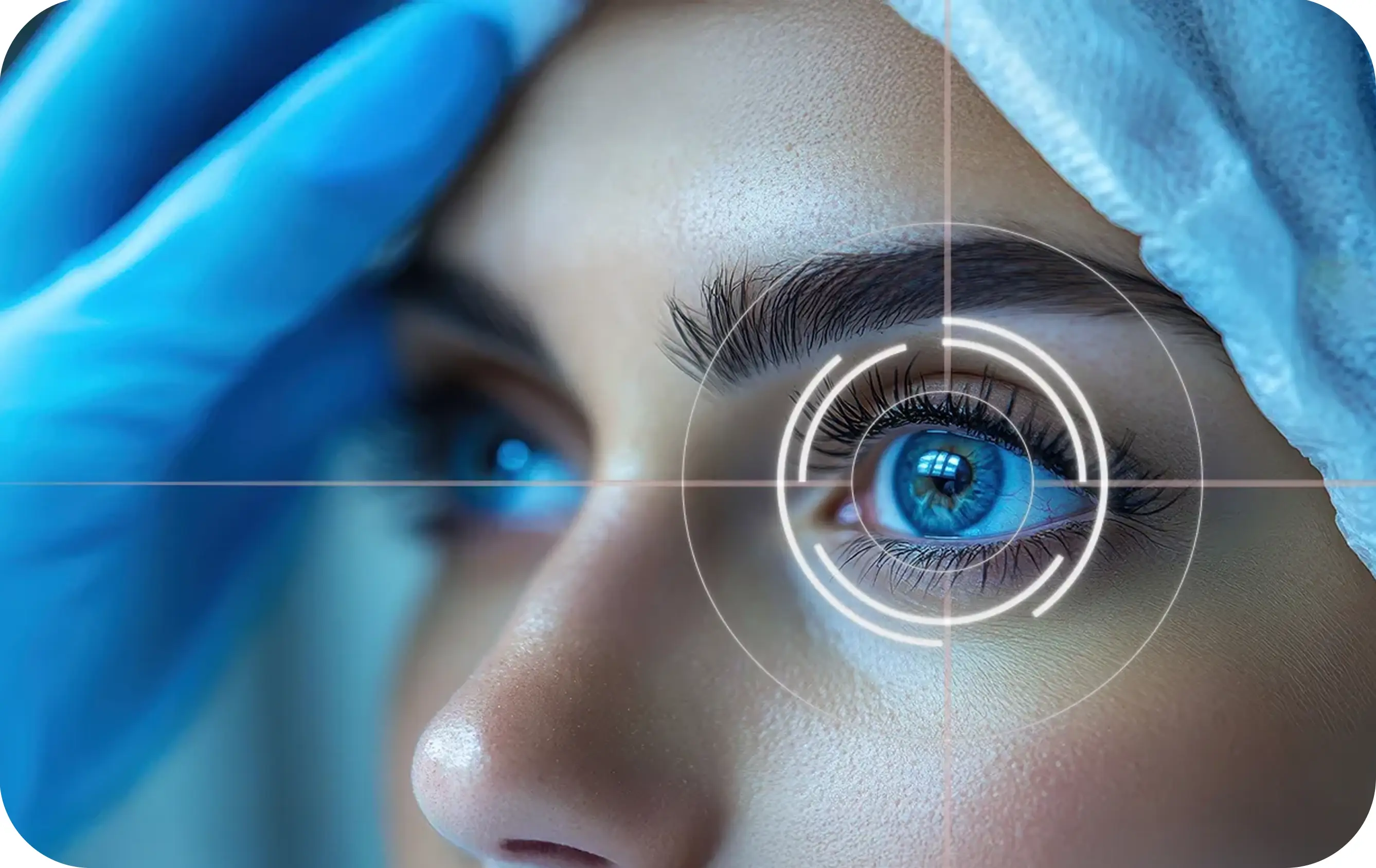 LASIK Eye Surgery