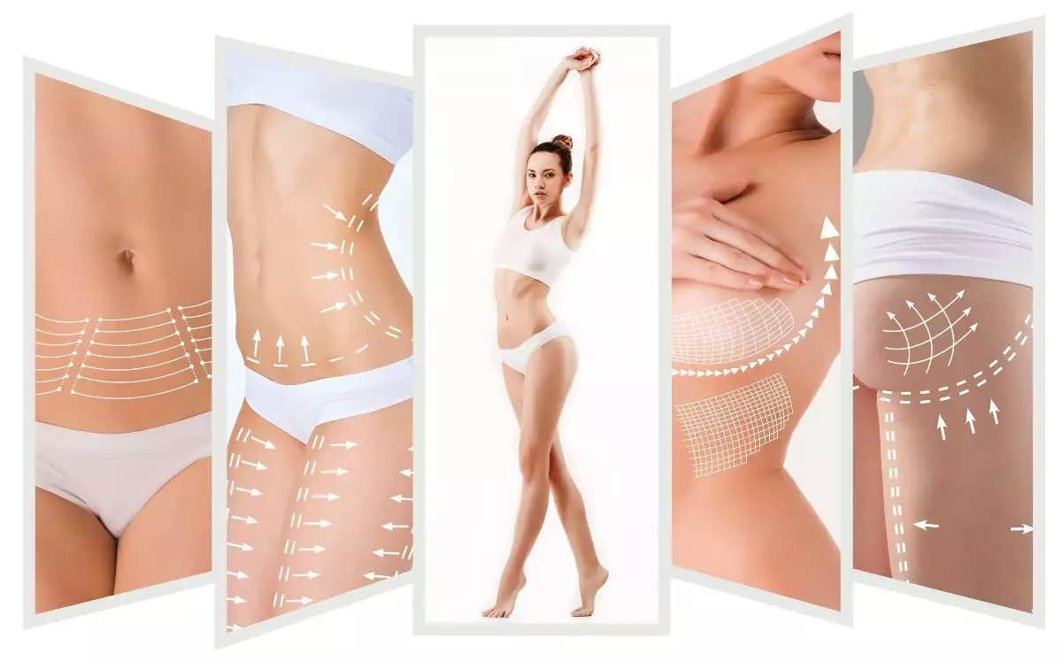 Reverse Tummy Tuck - Reverse Abdominoplasty Surgery - Revitalize In Turkey  - Boutique Treatment Provider with Exclusive Aftercare Services